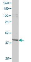 Anti-PBK Mouse Monoclonal Antibody [clone: 3F7]