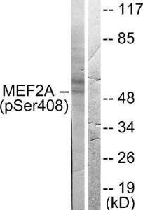 Anti-MEF2A