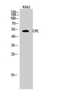 Western blot analysis of K562 cells using Anti-CPE Antibody