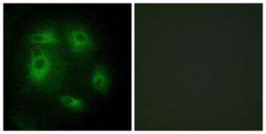 Immunofluorescence analysis of HeLa cells using Anti-DLEC1 Antibody. The right hand panel represents a negative control, where the antibody was pre-incubated with the immunising peptide