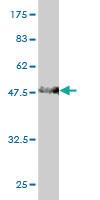 Anti-RBP4 Mouse Monoclonal Antibody [clone: 3D12]