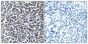 Immunohistochemical analysis of paraffin-embedded human tonsil tissue using Anti-TACC3 Antibody. The right hand panel represents a negative control, where the antibody was pre-incubated with the immunising peptide