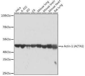 Western blot analysis of extracts of various cell lines, using Anti-muscle Actin Antibody [ARC1914] (A306344) at 1:1000 dilution