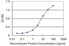 Anti-AAK1 Mouse Monoclonal Antibody [clone: 4B10]