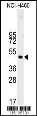 Anti-Desmin, T16 Rabbit Polyclonal Antibody (FITC (Fluorescein))