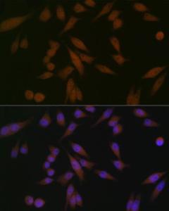 Immunofluorescence analysis of HeLa cells using Anti-PAR4 Antibody [ARC1980] (A309260) at a dilution of 1:100 (40x lens). DAPI was used to stain the cell nuclei (blue).