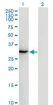 Anti-SSX2 Mouse Monoclonal Antibody [clone: 1A4]