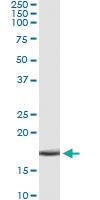 Anti-APOC4 Antibody Pair