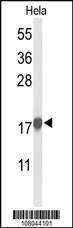 Anti-CDKN1A Rabbit Polyclonal Antibody (APC (Allophycocyanin))