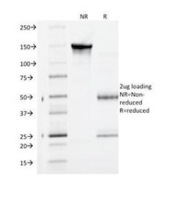 Anti-VEGF Receptor 1 antibody