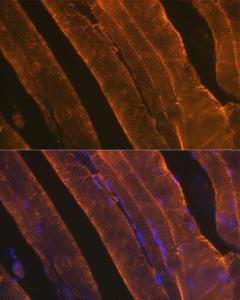 Immunofluorescence analysis of rat skeletal muscle using Anti-muscle Actin Antibody [ARC1914] (A306344) at a dilution of 1:100 (40x lens). DAPI was used to stain the cell nuclei (blue)