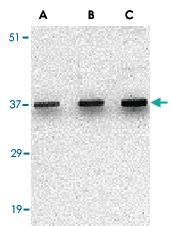 Anti-UNG Rabbit Polyclonal Antibody