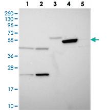 Anti-TIGD6 Rabbit Polyclonal Antibody