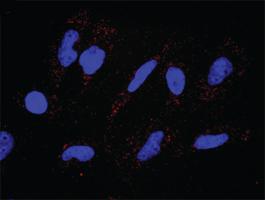 Anti-PDGFRA Antibody Pair