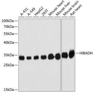 Western blot analysis of extracts of various cell lines, using Anti-HIBADH Antibody (A305430) at 1:3,000 dilution. The secondary antibody was Goat Anti-Rabbit IgG H&L Antibody (HRP) at 1:10,000 dilution.