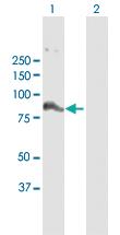 Anti-FBXO40 Rabbit Polyclonal Antibody