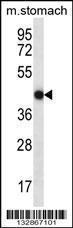 Anti-FGD2 Rabbit Polyclonal Antibody (FITC (Fluorescein Isothiocyanate))