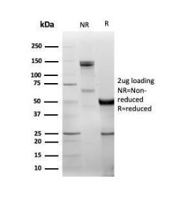 SDS-PAGE analysis of Anti-DBC2 Antibody [DBC2/3361] under non-reduced and reduced conditions; showing intact IgG and intact heavy and light chains, respectively. SDS-PAGE analysis confirms the integrity and purity of the antibody