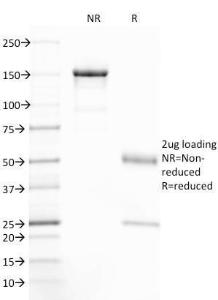 SDS-PAGE analysis of Anti-CFTR Antibody [CFTR/1785] under non-reduced and reduced conditions; showing intact IgG and intact heavy and light chains, respectively. SDS-PAGE analysis confirms the integrity and purity of the antibody