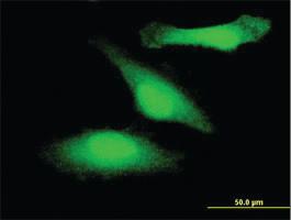 Anti-GSK3B Mouse Monoclonal Antibody [clone: 1H3]