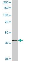 Anti-PBK Mouse Monoclonal Antibody [clone: 3F7]