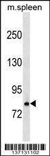 Anti-RNASEL Rabbit Polyclonal Antibody (HRP (Horseradish Peroxidase))