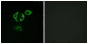 Immunofluorescence analysis of A549 cells using Anti-TACC3 Antibody. The right hand panel represents a negative control, where the antibody was pre-incubated with the immunising peptide