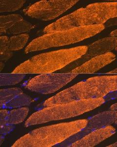 Immunofluorescence analysis of mouse skeletal muscle using Anti-muscle Actin Antibody [ARC1914] (A306344) at a dilution of 1:100 (40x lens). DAPI was used to stain the cell nuclei (blue)