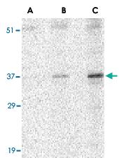 Anti-UNG Rabbit Polyclonal Antibody