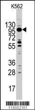 Anti-Myosin 1C Rabbit Polyclonal Antibody (HRP (Horseradish Peroxidase))