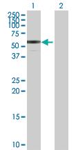 Anti-ENTPD3 Rabbit Polyclonal Antibody