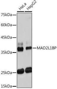 Western blot analysis of extracts of various cell lines, using Anti-CMT2 Antibody [ARC2187] (A309262) at 1:1,000 dilution