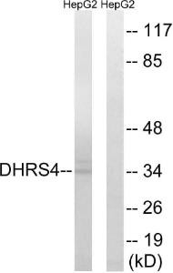 Anti-DHRS4 antibody