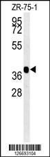 Anti-NIPAL2 Rabbit Polyclonal Antibody (HRP (Horseradish Peroxidase))