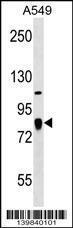 Anti-FGD3 Rabbit Polyclonal Antibody (AP (Alkaline Phosphatase))