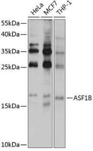 Antibody anti-ASF1B 100 µl