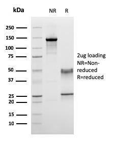 SDS-PAGE analysis of Anti-CD45RA Antibody [158-4D3] under non-reduced and reduced conditions; showing intact IgG and intact heavy and light chains, respectively. SDS-PAGE analysis confirms the integrity and purity of the antibody.