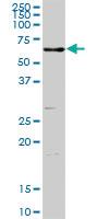 Anti-ENTPD3 Rabbit Polyclonal Antibody