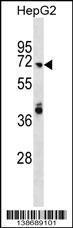 Anti-ARHGAP40 Rabbit Polyclonal Antibody (Biotin)