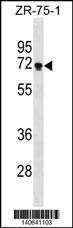 Anti-ZNF654 Rabbit Polyclonal Antibody (APC (Allophycocyanin))