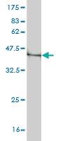 Anti-PLEC Mouse Monoclonal Antibody [clone: 4D12]