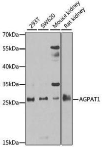 Western blot analysis of extracts of various cell lines, using Anti-AGPAT1 Antibody (A9899) at 1:1,000 dilution