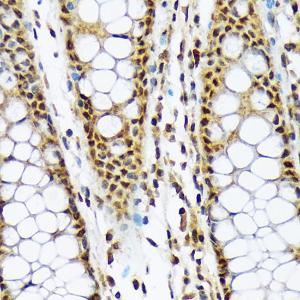 Immunohistochemistry analysis of paraffin-embedded human colon tissue using Anti-CMT2 Antibody [ARC2187] (A309262) at a dilution of 1:100 (40X lens). Perform microwave antigen retrieval with 10 mM Tris/EDTA buffer pH 9.0 before commencing with IHC staining protocol