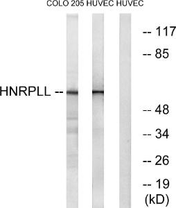 Western blot analysis of lysates from HUVEC and COLO cells using Anti-HNRPLL Antibody. The right hand lane represents a negative control, where the Antibody is blocked by the immunising peptide