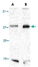 Anti-BAG1 Rabbit Polyclonal Antibody