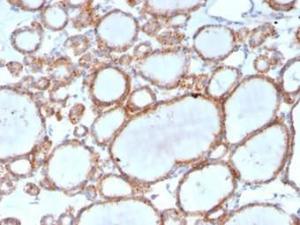 Immunohistochemical analysis of formalin-fixed, paraffin-embedded human thyroid using Anti-DBC2 Antibody [DBC2/3361] at 2 µg/ml in PBS for 30 minutes at room temperature