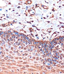 Immunohistochemistry analysis of paraffin-embedded human esophageal using Anti-HIBADH Antibody (A305430) at a dilution of 1:100 (40x lens). Perform microwave antigen retrieval with 10 mM PBS buffer pH 7.2 before commencing with IHC staining protocol.