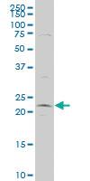 Anti-CMPK1 Mouse Polyclonal Antibody