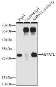 Immunoprecipitation analysis of 200 µg extracts of 293T cells using 3 µg of Anti-AGPAT1 Antibody (A9899). This Western blot was performed on the immunoprecipitate using Anti-AGPAT1 Antibody (A9899) at a dilution of 1:1000