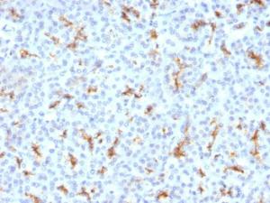 Immunohistochemical analysis of formalin-fixed, paraffin-embedded human pancreas using Anti-CFTR Antibody [CFTR/1342]